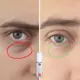 Specialus pasiūlymas! 2 LUMIN EYE + 1 LUMIN EYE DOVANŲ! 